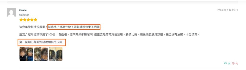 真實客戶回饋評論: 客戶曾用幾萬元做頭皮護理但是效果不明顯。 感謝客戶的信任，用D'REVIVER效果肉眼可見.