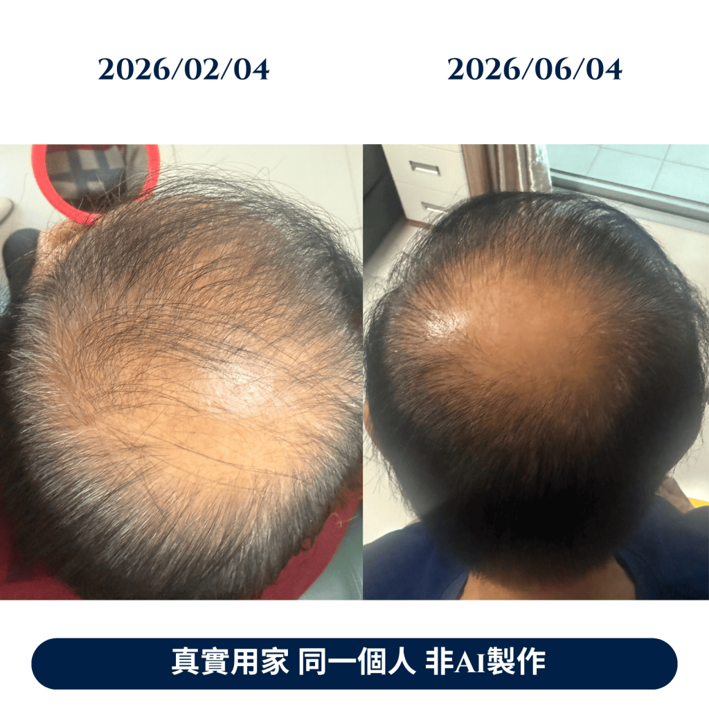 真實用家 長者也有意思不到的效果 不要放棄 總有希望