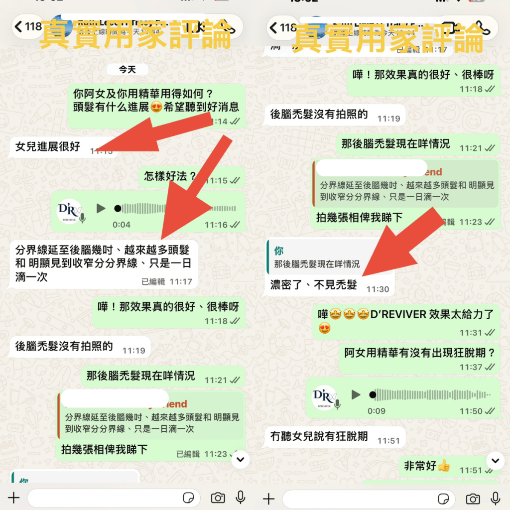 少女用DREVIVER2個半月的回饋評論
